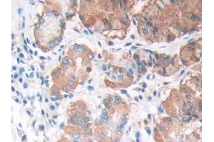 DAB staining on IHC-P; Samples: Human Stomach Tissue (LIPF Antikörper  (AA 20-398))