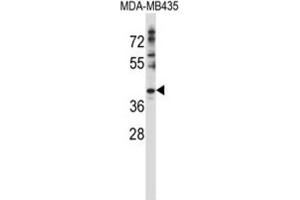 Western Blotting (WB) image for anti-DnaJ (Hsp40) Homolog, Subfamily C, Member 28 (DNAJC28) antibody (ABIN2997421) (DNAJC28 Antikörper)