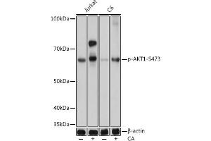 Western blot analysis of extracts of various cell lines, using Phospho--S473 mAb (ABIN6135179, ABIN6135970, ABIN6135971 and ABIN7101880) at 1:1000 dilution. (AKT1 Antikörper  (pSer473))