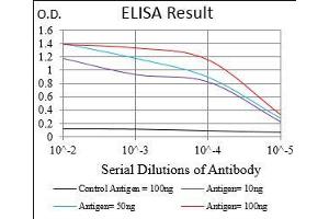 Black line: Control Antigen (100 ng), Purple line: Antigen(10 ng), Blue line: Antigen (50 ng), Red line: Antigen (100 ng), (CDX2 Antikörper  (AA 176-303))