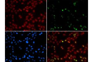 Immunofluorescence analysis of GFP-RNF168 trangenic U2OS cell using SUMO1 antibody. (SUMO1 Antikörper  (AA 1-101))