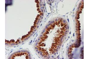 Immunohistochemistry (IHC) image for anti-Myocyte Enhancer Factor 2C (MEF2C) antibody (ABIN1499365) (MEF2C Antikörper)