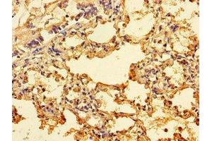 Immunohistochemistry of paraffin-embedded human lung tissue using ABIN7156249 at dilution of 1:100 (ING3 Antikörper  (AA 51-223))