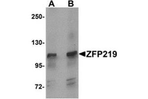 Western blot analysis of ZFP219 in mouse brain tissue lysate with ZFP219 antibody at (A) 1 and (B) 2 μg/ml. (ZNF219 Antikörper  (N-Term))