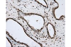 Immunohistochemical staining of paraffin-embedded Kidney tissue using anti-APP mouse monoclonal antibody. (APP Antikörper)