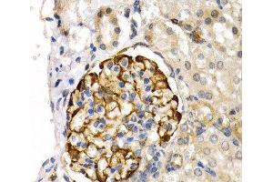 Immunohistochemistry of paraffin-embedded Rat kidney using LIPG Polyclonal Antibody at dilution of 1:200 (40x lens). (LIPG Antikörper)