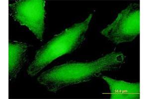 Immunofluorescence of purified MaxPab antibody to PSMD10 on HeLa cell. (PSMD10 Antikörper  (AA 1-226))