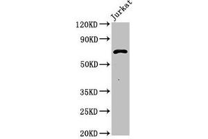 Western Blot Positive WB detected in: Jurkat whole cell lysate All lanes: Pcsk1 antibody at 3 μg/mL Secondary Goat polyclonal to rabbit IgG at 1/50000 dilution Predicted band size: 71 kDa Observed band size: 71 kDa (PCSK2 Antikörper  (AA 109-637))