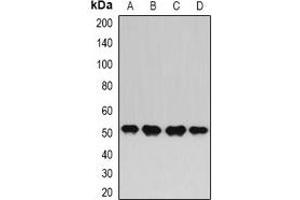 Western blot analysis of HAPLN1 expression in BT474 (A), MCF7 (B), Hela (C), HepG2 (D) whole cell lysates.