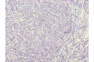 Immunohistochemistry of paraffin-embedded human tonsil tissue using ABIN7171361 at dilution of 1:100 (TRIM Antikörper  (AA 29-186))