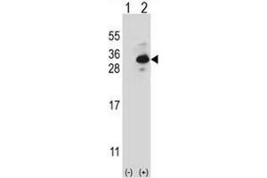 Western blot analysis of CLTB (arrow) using rabbit polyclonal CLTB Antibody . (CLTB Antikörper  (Light Chain))
