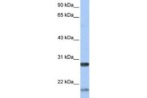 WB Suggested Anti-BDNF Antibody Titration:  0. (BDNF Antikörper  (Middle Region))