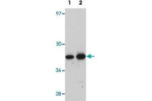 Western blot analysis of rat kidney tissue with ANAPC7 polyclonal antibody  at (Lane 1) 1 and (Lane 2) 2 ug/mL dilution. (ANAPC7 Antikörper  (C-Term))