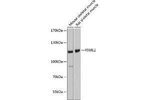 Western blot analysis of extracts of various cell lines, using PIWIL2 antibody (ABIN6132495, ABIN6145700, ABIN6145701 and ABIN6221680) at 1:1000 dilution.