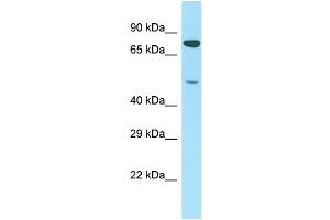 Host: Rabbit Target Name: PTCD1 Sample Type: Jurkat Whole Cell lysates Antibody Dilution: 1. (PTCD1 Antikörper  (N-Term))