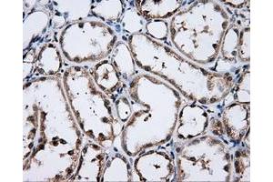 Immunohistochemical staining of paraffin-embedded Kidney tissue using anti-LIPG mouse monoclonal antibody. (LIPG Antikörper)