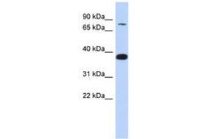 Image no. 1 for anti-Zinc Finger Protein 526 (ZNF526) (AA 179-228) antibody (ABIN6740285) (ZNF526 Antikörper  (AA 179-228))