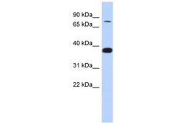 ZNF526 抗体  (AA 179-228)