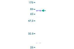 Image no. 1 for Zinc Finger, MYND-Type Containing 10 (ZMYND10) (AA 1-440) protein (GST tag) (ABIN1325843) (ZMYND10 Protein (AA 1-440) (GST tag))