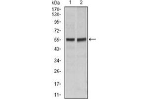 Western Blotting (WB) image for anti-TNF Receptor Superfamily, Member 6 (FAS) antibody (ABIN1106616) (FAS Antikörper)
