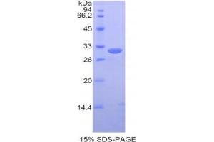 SDS-PAGE analysis of Human PDIA3 Protein. (PDIA3 Protein)