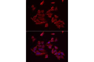 Immunofluorescence analysis of MCF-7 cell using RARRES2 antibody. (Chemerin Antikörper)