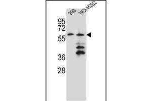 PREF12 Antibody (Center) (ABIN656063 and ABIN2845415) western blot analysis in 293,NCI- cell line lysates (35 μg/lane). (PRAMEF12 Antikörper  (AA 107-135))