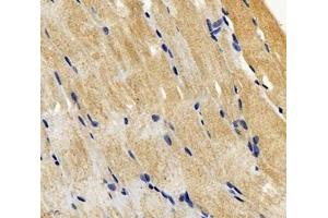 Immunohistochemistry analysis of paraffin-embedded mouse skeletal muscle using SGCA (ABIN7075509) at dilution of 1: 600 (SGCA Antikörper)
