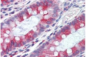 Human Colon (formalin-fixed, paraffin-embedded) stained with TUBB antibody ABIN462130 followed by biotinylated anti-mouse IgG secondary antibody ABIN481714, alkaline phosphatase-streptavidin and chromogen.