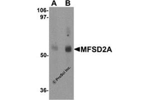 Western blot analysis of MFSD2A in rat lung tissue lysate with MFSD2A antibody at (A) 1 and (B) 2 μg/ml. (MFSD2A Antikörper  (C-Term))