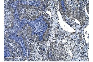 IHC analysis of NRF1 using anti-NRF1 antibody (ABIN7600874). (NRF1 Antikörper  (AA 246-503))