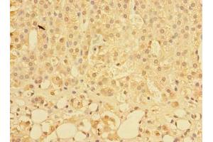 Immunohistochemistry of paraffin-embedded human adrenal gland tissue using ABIN7163662 at dilution of 1:100 (C10orf81 Antikörper  (AA 181-462))