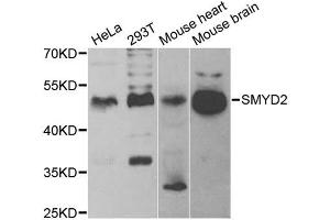 Western blot analysis of extracts of various cell lines, using SMYD2 antibody (ABIN5973871) at 1/1000 dilution.