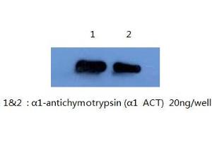 Western Blotting (WB) image for anti-serpin Peptidase Inhibitor, Clade A (Alpha-1 Antiproteinase, Antitrypsin), Member 3 (SERPINA3) antibody (ABIN1105306) (SERPINA3 Antikörper)