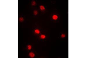 Immunofluorescent analysis of DNMT3B staining in A549 cells.