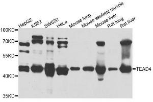 Western blot analysis of extracts of various cell lines, using TEAD4 antibody. (TEAD4 Antikörper  (AA 110-250))