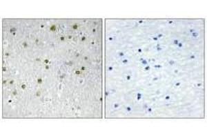 Immunohistochemistry analysis of paraffin-embedded human brain tissue, using NRIP2 antibody. (NRIP2 Antikörper  (N-Term))