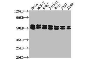 Western Blot Positive WB detected in: Hela whole cell lysate, MCF-7 whole cell lysate, K562 whole cell lysate, Jurkat whole cell lysate, Raji whole cell lysate, 293T whole cell lysate, A549 whole cell lysate All lanes: DNAJA3 antibody at 1:2000 Secondary Goat polyclonal to rabbit IgG at 1/50000 dilution Predicted band size: 53, 50, 34 kDa Observed band size: 53 kDa (DNAJA3 Antikörper  (AA 86-184))