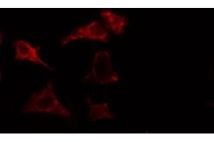 ABIN6275453 staining HuvEc cells by IF/ICC. (IQGAP3 Antikörper  (N-Term))