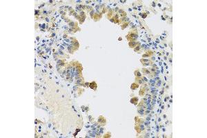Immunohistochemistry of paraffin-embedded mouse lung using RSPO1 antibody at dilution of 1:100 (40x lens). (RSPO1 Antikörper)