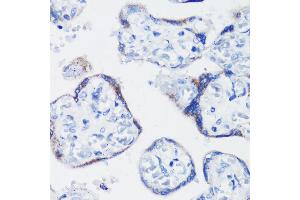 Immunohistochemistry of paraffin-embedded human placenta using KISS1 antibody (ABIN3017121, ABIN3017122, ABIN1680598 and ABIN6219966) at dilution of 1:200 (40x lens). (KISS1 Antikörper)