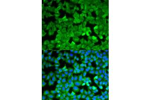 Immunofluorescence (IF) image for anti-Asparagine Synthetase (ASNS) antibody (ABIN1876738) (Asparagine Synthetase Antikörper)