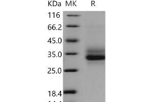 Western Blotting (WB) image for C-Type Lectin Domain Family 7, Member A (CLEC7A) protein (His tag) (ABIN7320355)