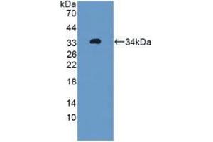Detection of Recombinant OIT3, Rat using Polyclonal Antibody to Oncoprotein Induced Transcript 3 (OIT3) (OIT3 Antikörper  (AA 251-524))