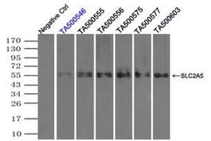 Image no. 2 for anti-Solute Carrier Family 2 (Facilitated Glucose/fructose Transporter), Member 5 (SLC2A5) antibody (ABIN1498478) (SLC2A5 Antikörper)