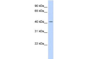 WB Suggested Anti-DHDDS Antibody Titration:  0. (DHDDS Antikörper  (N-Term))