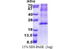 HES2 Protein (AA 1-173) (His tag)