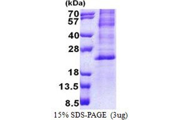HES2 Protein (AA 1-173) (His tag)
