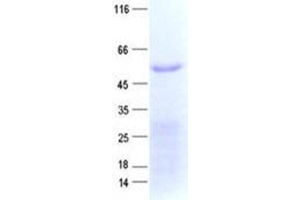 ZNF480 Protein (His tag)