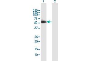 Western Blotting (WB) image for anti-X-Ray Repair Complementing Defective Repair in Chinese Hamster Cells 4 (XRCC4) (AA 1-336) antibody (ABIN521432)